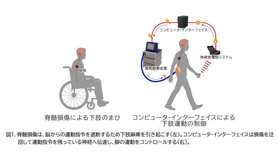 外科手術なしで脊髄損傷を迂回し信号を伝える手法、リハビリとしても有効か