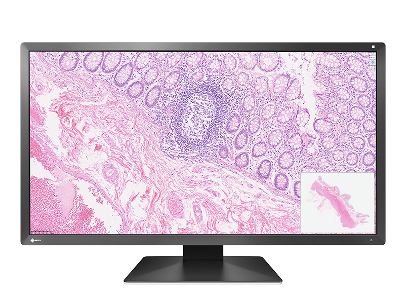 EIZO初、色精度を簡単に維持できる病理画像向け30.5型4Kモニター